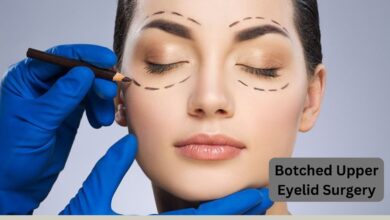 botched upper eyelid surgery