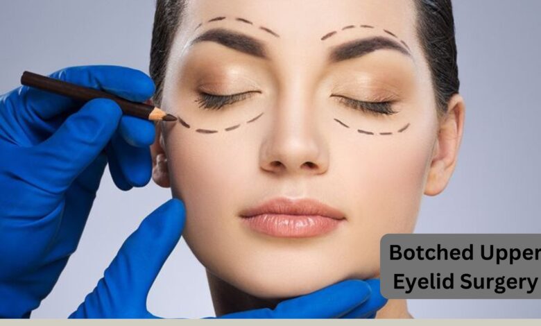 botched upper eyelid surgery